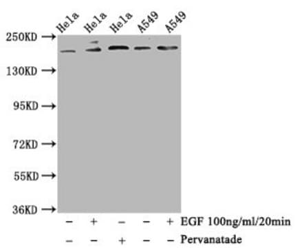 Anti-phospho-PDGFRB (Y740) antibody, clone 3B8, Rabbit Monoclonal recombinant, expressed in HEK293F cells
