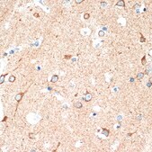 Anti-DCR2 Antibody, clone 10Y1N4, Rabbit Monoclonal