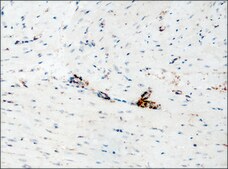 Anti-Destrin/ADF (GV-13) antibody produced in rabbit affinity isolated antibody, buffered aqueous solution