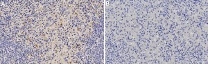 Anti-TIM-3/HAVCR2 Antibody, clone 2B7-L1 ZooMAb® Rabbit Monoclonal recombinant, expressed in HEK 293 cells
