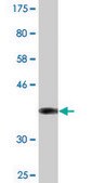 Monoclonal Anti-CCS antibody produced in mouse clone 1E2, purified immunoglobulin, buffered aqueous solution