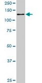 Monoclonal Anti-CAND1 antibody produced in mouse clone 5F2, purified immunoglobulin, buffered aqueous solution