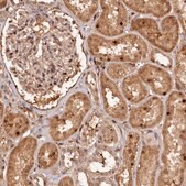 Anti-TRAPPC4 antibody produced in rabbit Prestige Antibodies&#174; Powered by Atlas Antibodies, affinity isolated antibody, buffered aqueous glycerol solution