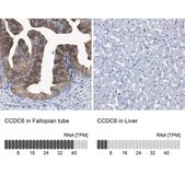Anti-CCDC6 antibody produced in rabbit Prestige Antibodies® Powered by Atlas Antibodies, affinity isolated antibody, buffered aqueous glycerol solution, Ab2