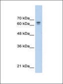 Anti-PARP6 antibody produced in rabbit affinity isolated antibody