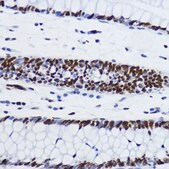 Anti-Acetyl-Histone H2B-K12 antibody produced in rabbit