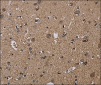 Anti-TRPM1 antibody produced in rabbit affinity isolated antibody