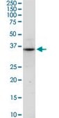 Anti-C17orf75 antibody produced in rabbit purified immunoglobulin, buffered aqueous solution
