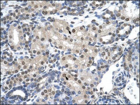 Anti-SNRP70 (AB1) antibody produced in rabbit affinity isolated antibody
