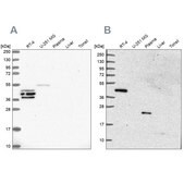 Anti-SPESP1 antibody produced in rabbit Prestige Antibodies&#174; Powered by Atlas Antibodies, affinity isolated antibody, buffered aqueous glycerol solution