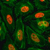 Anti-Monomethyl-Histone H3 (Lys4) antibody, Rabbit monoclonal recombinant, expressed in HEK 293 cells, clone RM140, purified immunoglobulin