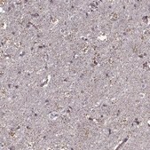 Anti-ASIC3 Prestige Antibodies&#174; Powered by Atlas Antibodies, affinity isolated antibody