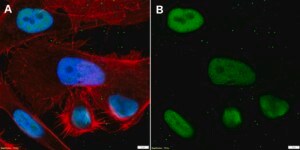 Anti-RAN Antibody, clone 1D6 ZooMAb® Rabbit Monoclonal recombinant, expressed in HEK 293 cells