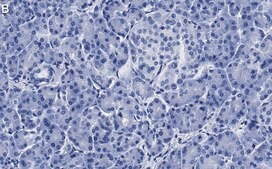 Anti-MICA Antibody, clone 4F8 ZooMAb® Rabbit Monoclonal recombinant, expressed in HEK 293 cells