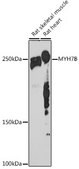 Anti-MYH7B Antibody, clone 7W8J3, Rabbit Monoclonal