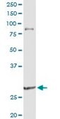 Anti-CLEC9A antibody produced in rabbit purified immunoglobulin, buffered aqueous solution