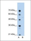 Anti-SLA/LP affinity isolated antibody