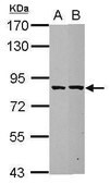 Anti-ESRP2 antibody produced in rabbit affinity isolated antibody, buffered aqueous solution