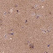 Anti-NAXE antibody produced in rabbit Prestige Antibodies&#174; Powered by Atlas Antibodies, affinity isolated antibody, buffered aqueous glycerol solution