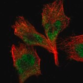 Anti-TAF10 antibody produced in rabbit Prestige Antibodies&#174; Powered by Atlas Antibodies, affinity isolated antibody, buffered aqueous glycerol solution