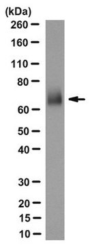 Anti- LTP/CETP Antibody, clone 3-11D clone 3-11D, from mouse