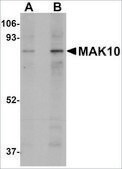 Anti-MAK10 antibody produced in rabbit affinity isolated antibody, buffered aqueous solution, ab2