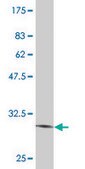 Monoclonal Anti-SLITL2 antibody produced in mouse clone 4G7, purified immunoglobulin, buffered aqueous solution