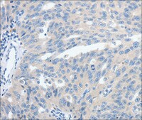 Anti-SSTR3 antibody produced in rabbit affinity isolated antibody