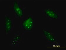 Anti-BXDC2 antibody produced in mouse purified immunoglobulin, buffered aqueous solution