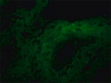 Anti-l-Afadin antibody produced in rabbit affinity isolated antibody, buffered aqueous solution