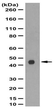 Anti-PAR-4 Antibody from rabbit, purified by affinity chromatography