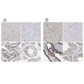 Anti-PCNT antibody produced in rabbit Prestige Antibodies&#174; Powered by Atlas Antibodies, affinity isolated antibody, buffered aqueous glycerol solution, Ab1