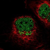 Anti-IL13RA1 antibody produced in rabbit Prestige Antibodies® Powered by Atlas Antibodies, affinity isolated antibody