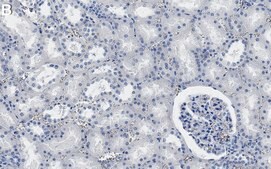 Anti-UBE2D1/UbcH5 Antibody, clone 1F22 ZooMAb&#174; Rabbit Monoclonal recombinant, expressed in HEK 293 cells