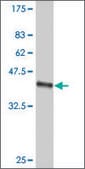 ANTI-SMO antibody produced in mouse clone 2D10, purified immunoglobulin, buffered aqueous solution