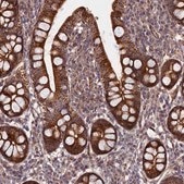 Anti-PIK3C3 antibody produced in rabbit Prestige Antibodies&#174; Powered by Atlas Antibodies, affinity isolated antibody, buffered aqueous glycerol solution