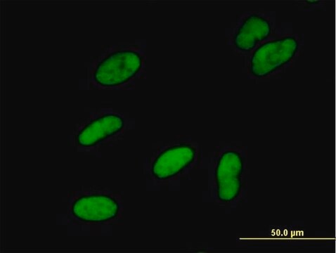 Anti-SMARCA5 antibody produced in mouse purified immunoglobulin, buffered aqueous solution