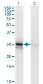 Monoclonal Anti-ALDOA antibody produced in mouse clone 3D9-6F3, purified immunoglobulin, buffered aqueous solution