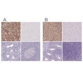 Anti-FDX1 antibody produced in rabbit Prestige Antibodies&#174; Powered by Atlas Antibodies, affinity isolated antibody, buffered aqueous glycerol solution