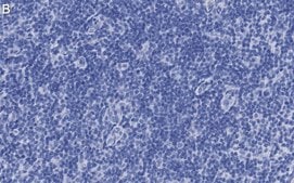 Anti-PD-1 Antibody, clone 1F7 ZooMAb® Rabbit Monoclonal recombinant, expressed in HEK 293 cells