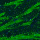 Monoclonal Anti-CNP antibody produced in mouse Prestige Antibodies® Powered by Atlas Antibodies, clone CL2872, purified immunoglobulin, buffered aqueous glycerol solution