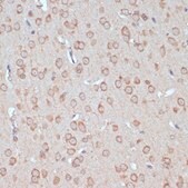 Anti-YAP1 antibody produced in rabbit