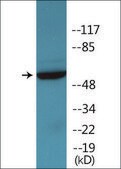 Anti-phospho-STAM2 (pTyr192) antibody produced in rabbit affinity isolated antibody