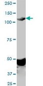 Monoclonal Anti-EPHA2 antibody produced in mouse clone 1E3, purified immunoglobulin, buffered aqueous solution