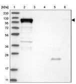 Anti-DHX36 antibody produced in rabbit Prestige Antibodies&#174; Powered by Atlas Antibodies, affinity isolated antibody, buffered aqueous glycerol solution