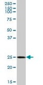 Anti-GOSR1 antibody produced in mouse IgG fraction of antiserum, buffered aqueous solution