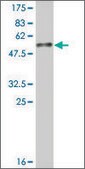 Monoclonal Anti-SERPINB8 antibody produced in mouse clone 1D10, ascites fluid