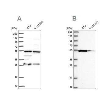 Anti-PACSIN3 antibody produced in rabbit Prestige Antibodies&#174; Powered by Atlas Antibodies, affinity isolated antibody, buffered aqueous glycerol solution