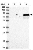 Anti-SOGA3 antibody produced in rabbit Prestige Antibodies&#174; Powered by Atlas Antibodies, affinity isolated antibody, buffered aqueous glycerol solution