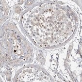 Anti-HOXA3 antibody produced in rabbit Prestige Antibodies® Powered by Atlas Antibodies, affinity isolated antibody, buffered aqueous glycerol solution